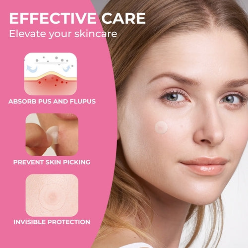 Hydrocolloid Acne Patches - Invisible & Fast-Absorbing (288 Count)