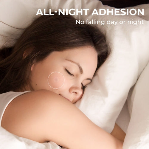 Hydrocolloid Acne Patches - Invisible & Fast-Absorbing (288 Count)