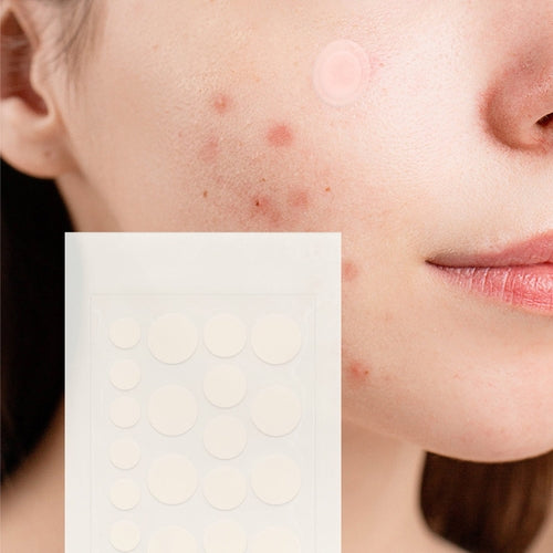 Hydrocolloid Pimple Patches 5-Pack – 120 Multi-Size Acne Patches